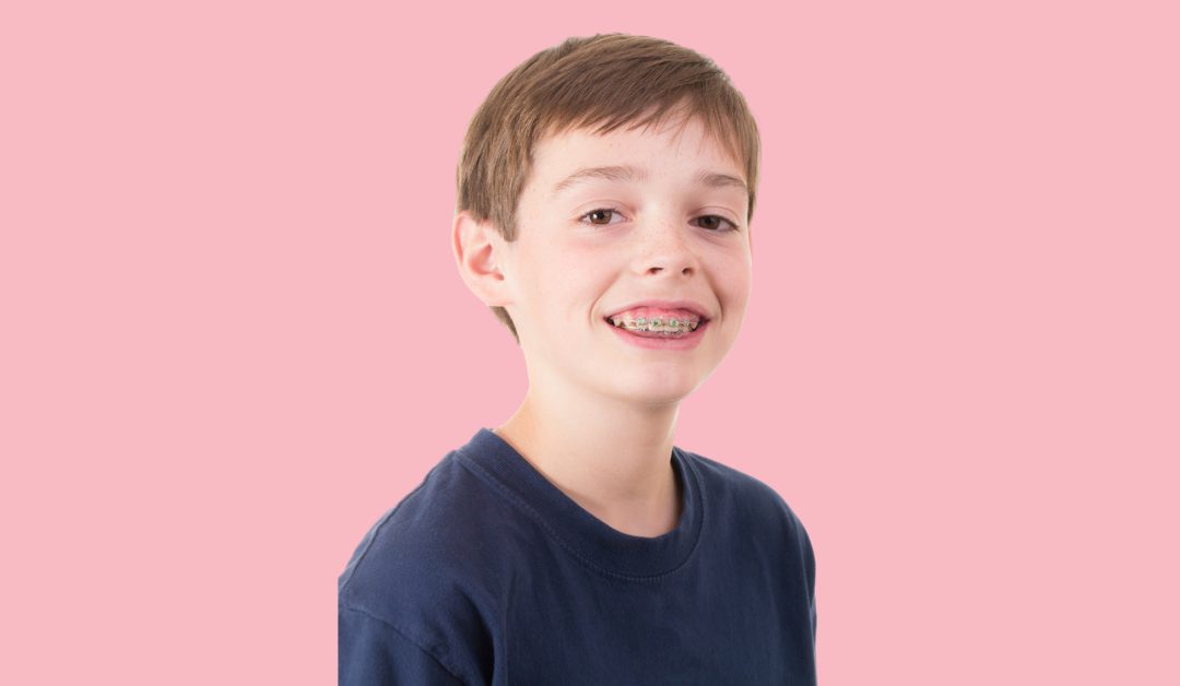 Smiling child with braces ont their teeth. They are wearing a navy tshirt and they have short, light brown hair.